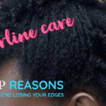 8 Causes of Thinning Hairline & Edges.