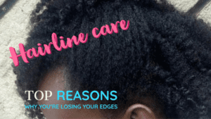 Read more about the article 8 Causes of Thinning Hairline & Edges.