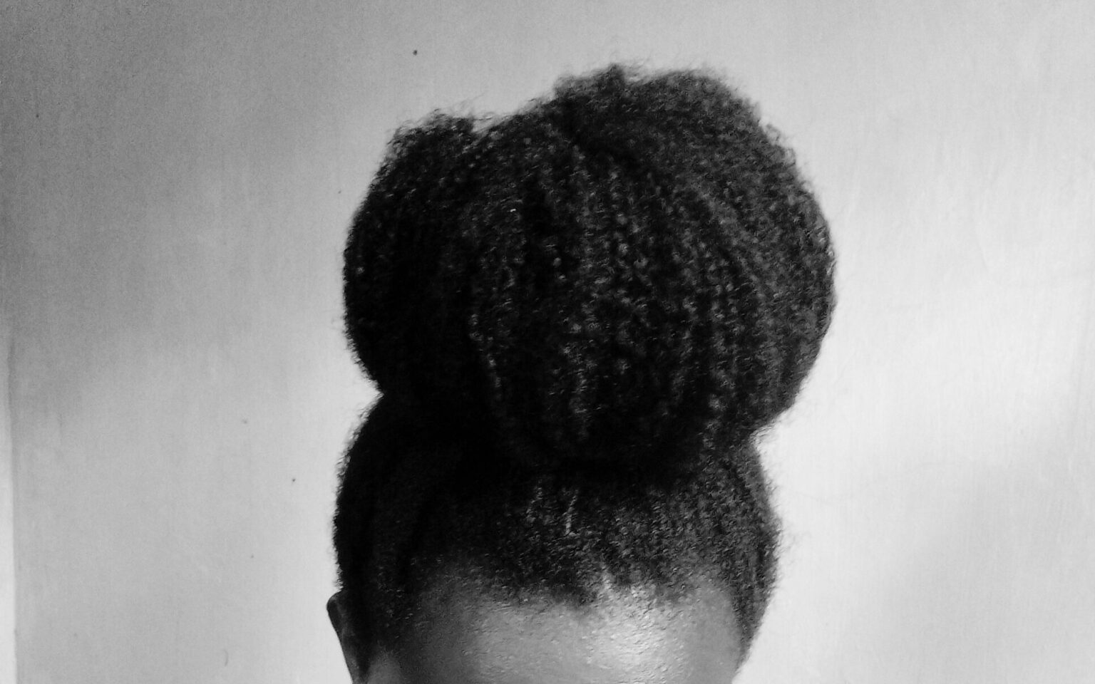 Major Causes Of Dry Scalp On 4C Natural Hair Napturally Val