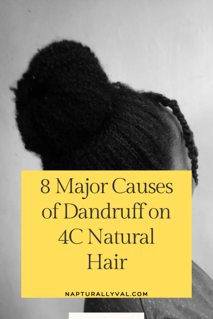 8 Major Causes of Dandruff on 4C Natural Hair