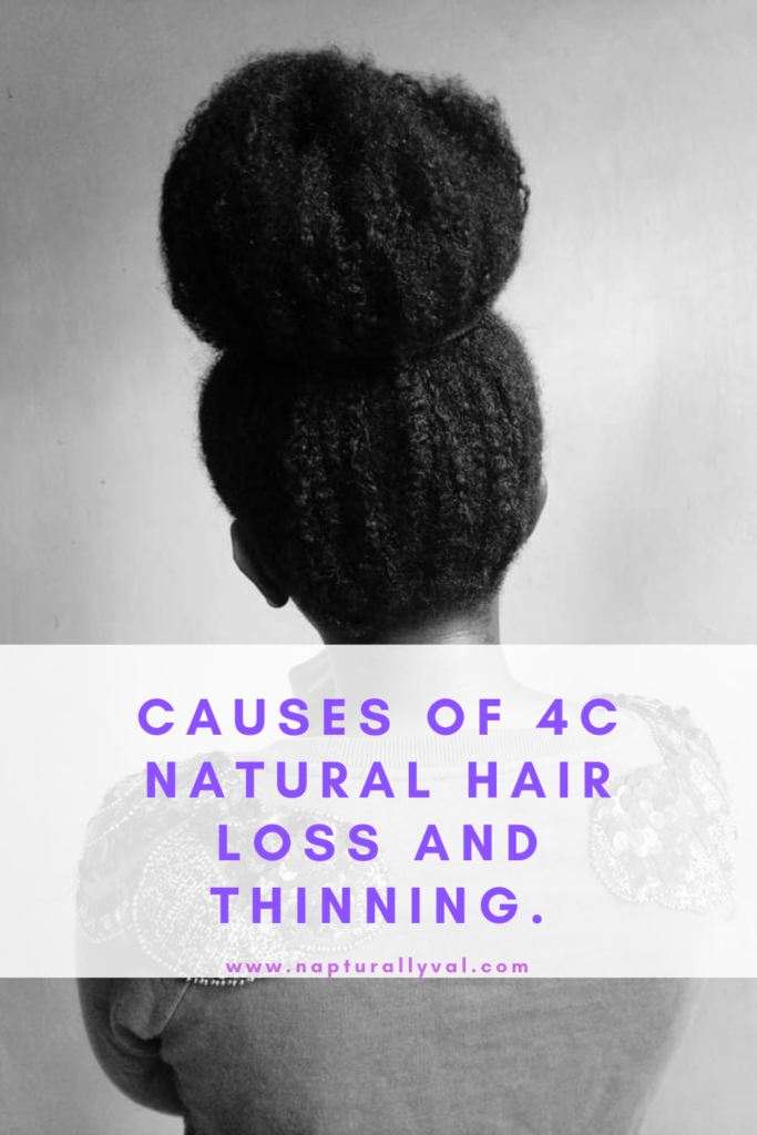 Causes of 4C Natural Hair Loss and Thinning.